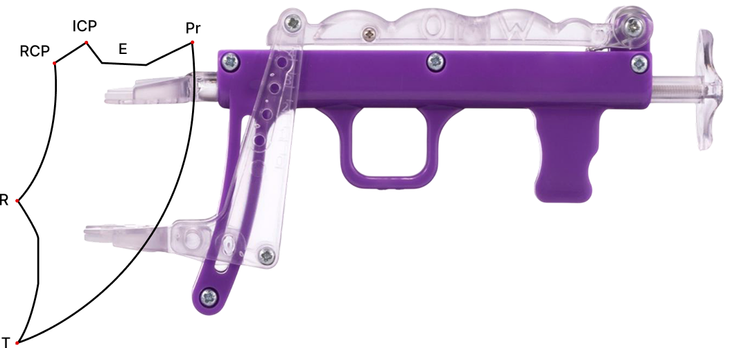 Фигура Posselt